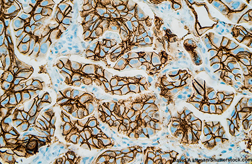 her2 positive cells